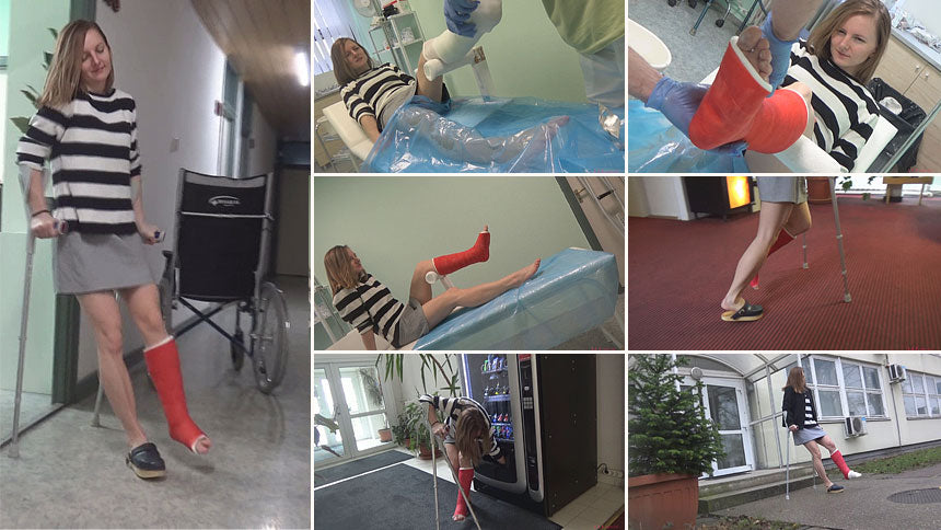 Jackie extreme pain cast application part II.