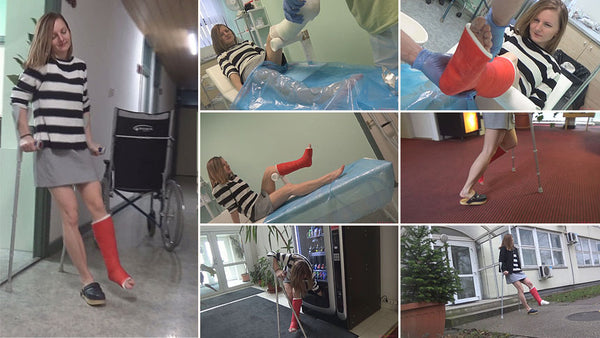 Jackie extreme pain cast application part II.